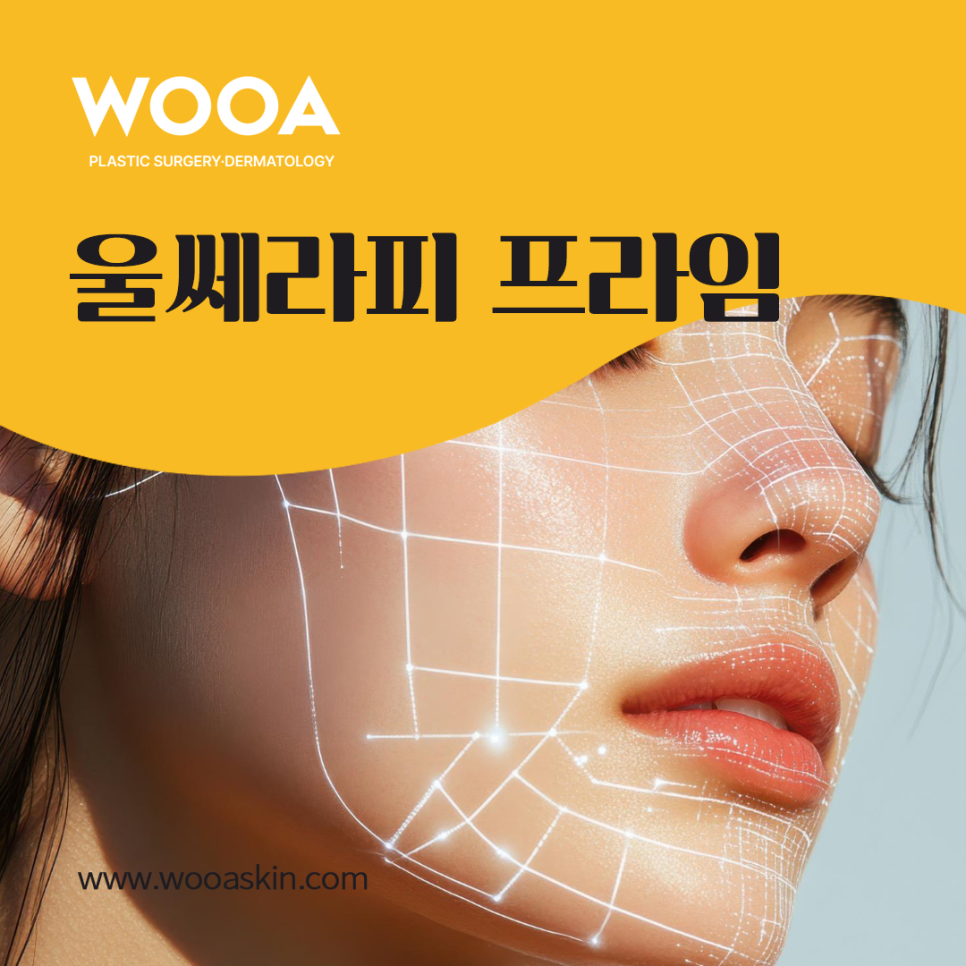 울쎄라피프라임 Ultherapy Prime 진짜 효과는? 관련 이미지 4