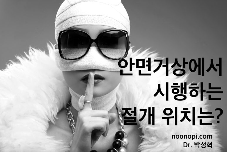 안면거상에서 시행하는 절개 위치는? 관련 이미지 1