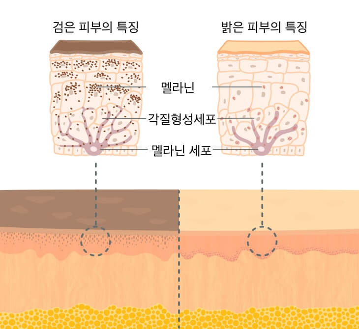 토닝 레이저 한 번으로 기미가 얼마나 좋아질까? 관련 이미지 7
