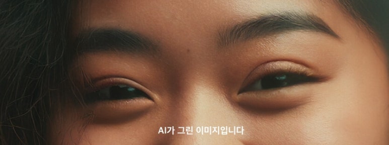 It’s Not the Burial Method That Caused the Droopy Sausage Eye After Double Eyelid Surgery image 3