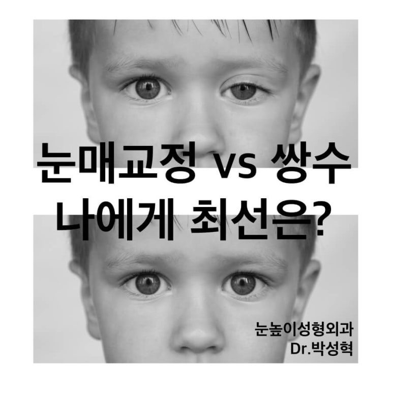 눈매교정과 쌍수 중 나에게 최선은? 관련 이미지 1