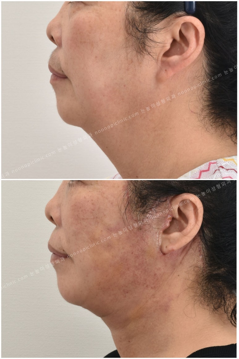 If You’re Looking Into Cosmetic Surgery as a Mother’s Day Gift for Your Parents image 13