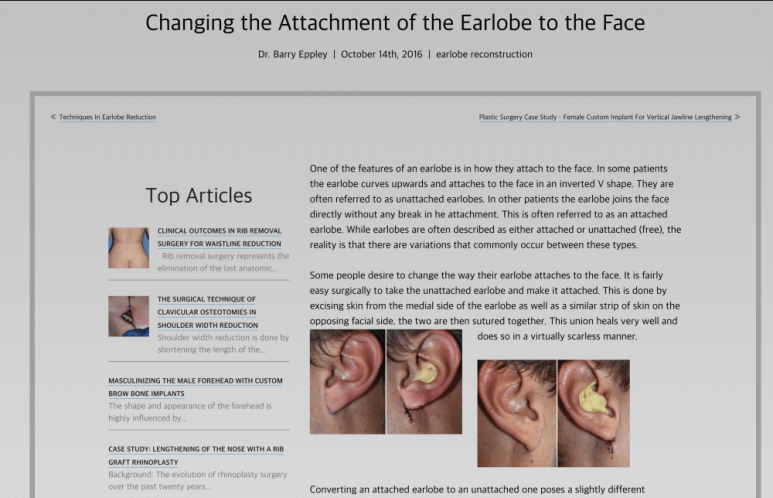 Facelift Scars and Recovery Time image 16
