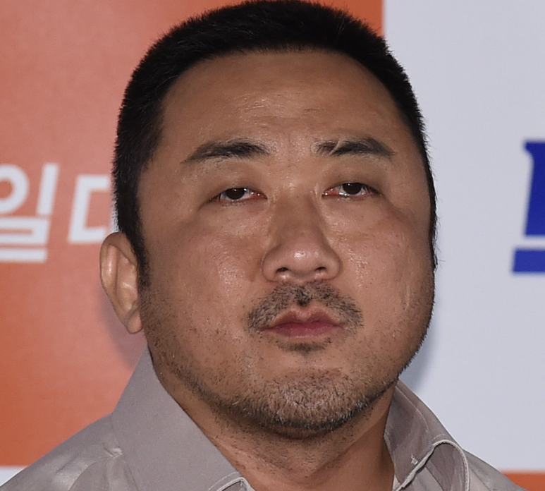 눈매교정 재수술 사례 : 고객과 합심해서 만든 결과 관련 이미지 1