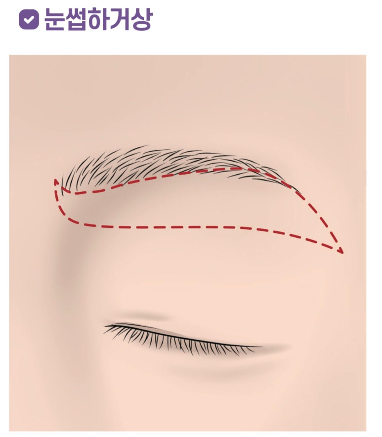 If You’re Looking Into Cosmetic Surgery as a Mother’s Day Gift for Your Parents image 4