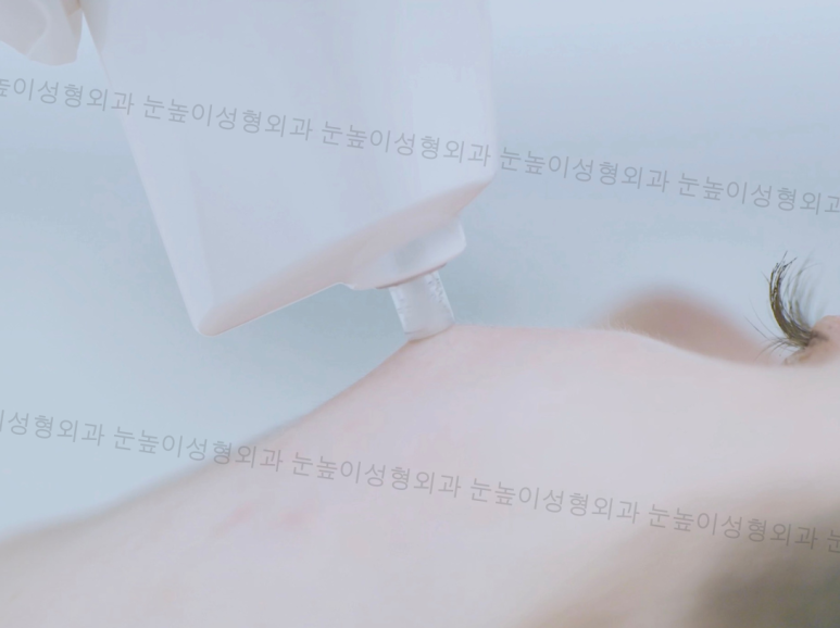 큐리티 피지제거 끝판왕 관련 이미지 9