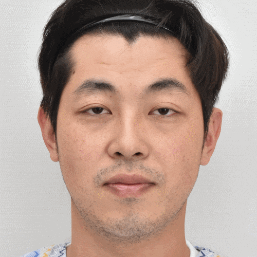 What Is Ptosis Correction? (Graphic Images Warning ⚠️) image 2