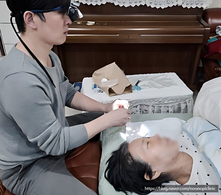 가족에게 추천한 눈밑하안검수술 24개월 경과 관련 이미지 6