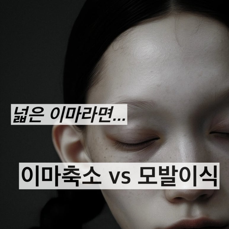 Forehead Reduction Surgery vs Hair Transplant image 2