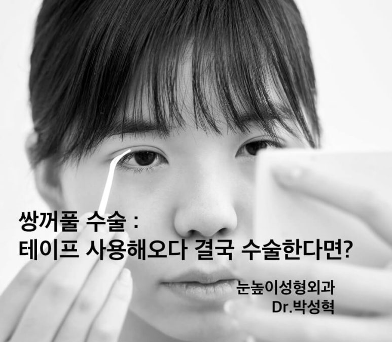 Creating Double Eyelids: What to Know If You’ve Been Using Tape and Eventually Decide on Surgery image 1