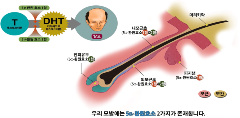 Forehead Reduction Surgery vs Hair Transplant image 22