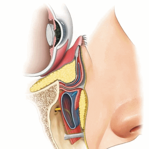 Lower Blepharoplasty vs. Fat Repositioning for Under-Eye Bags - Which Under-Eye Surgery Is Right for Me? image 15