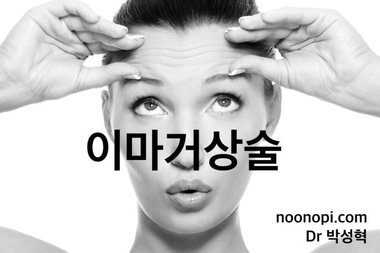 이마거상술 : 만족하는 대상과 수술 방법 관련 이미지 1