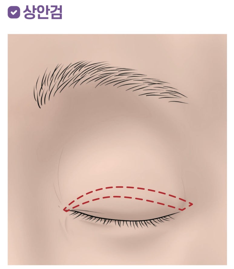 If You’re Looking Into Cosmetic Surgery as a Mother’s Day Gift for Your Parents image 1