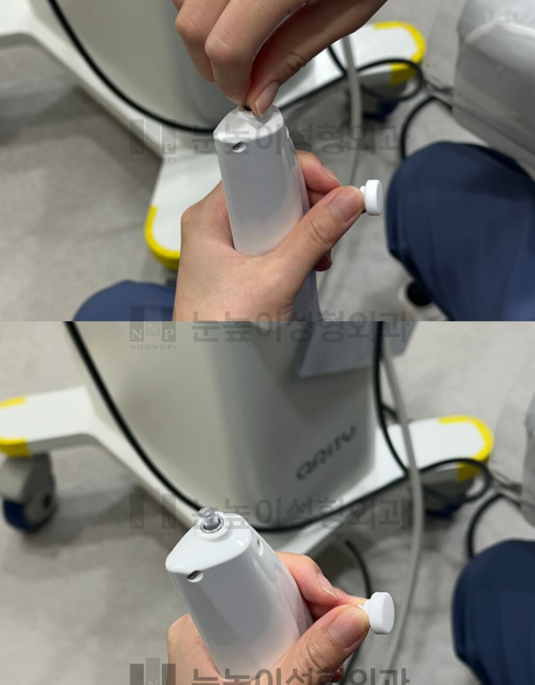 큐리티 피지제거 끝판왕 관련 이미지 8