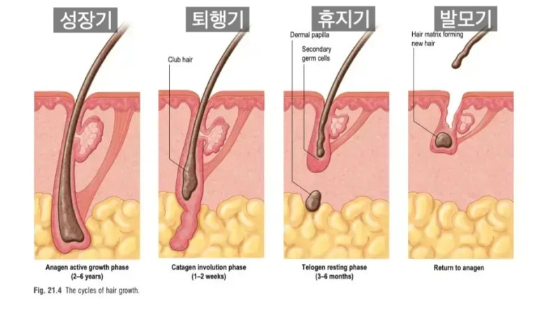 Brow Lift Scars and Hair Loss image 7