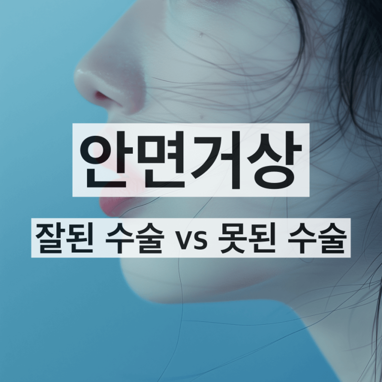 10 Things to Note About Facelift Results and Successful Before-and-After Cases image 1