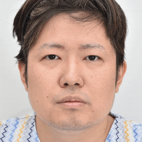 What Is Ptosis Correction? (Graphic Images Warning ⚠️) image 7