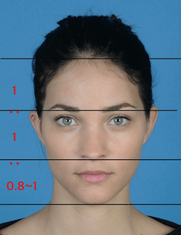 Forehead Reduction Surgery vs Hair Transplant image 3
