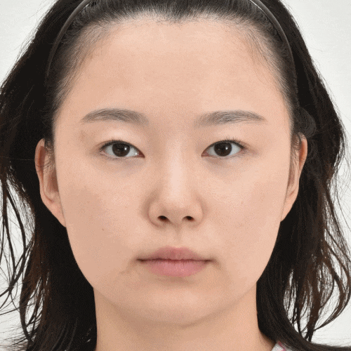 What Is Ptosis Correction? (Graphic Images Warning ⚠️) image 6