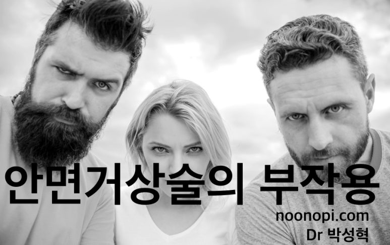 안면거상술의 부작용 관련 이미지 1
