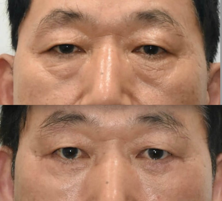 If You’re Looking Into Cosmetic Surgery as a Mother’s Day Gift for Your Parents image 10