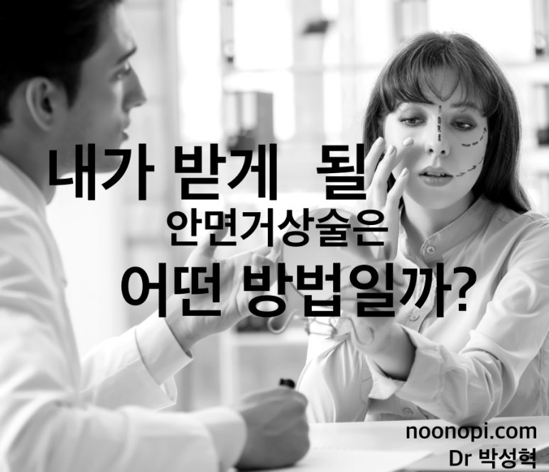 내가 받게 될 안면거상술은 어떤 방법일까? 관련 이미지 1