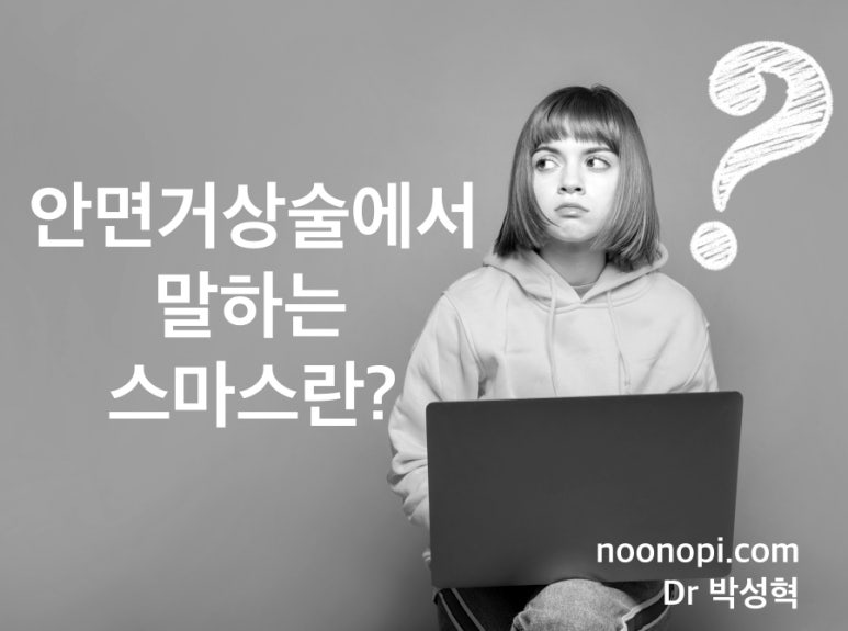 안면거상술에서 말하는 스마스란? 관련 이미지 1