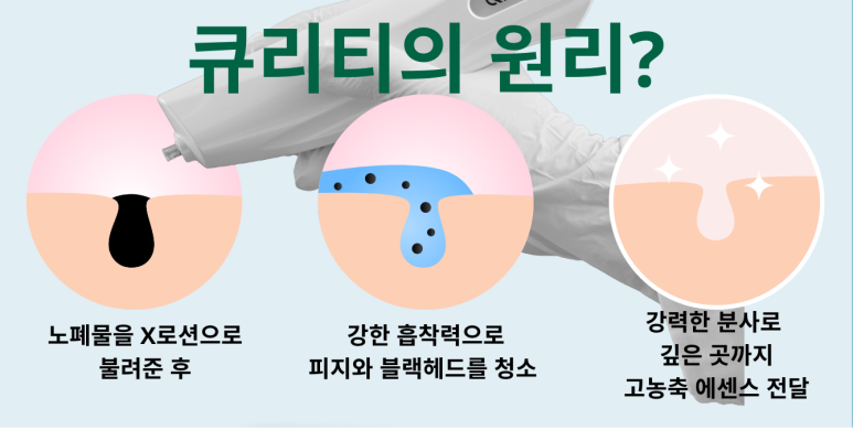 큐리티 피지제거 끝판왕 관련 이미지 3