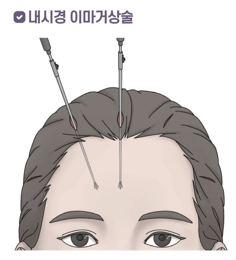 If You’re Looking Into Cosmetic Surgery as a Mother’s Day Gift for Your Parents image 6