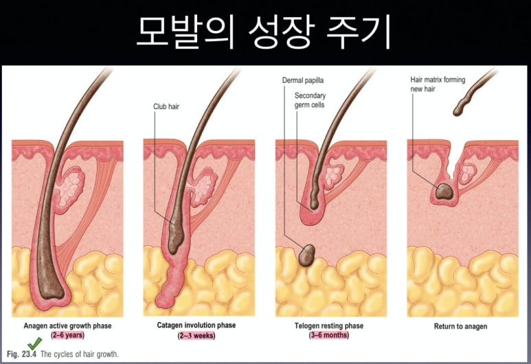 Forehead Reduction Surgery vs Hair Transplant image 5