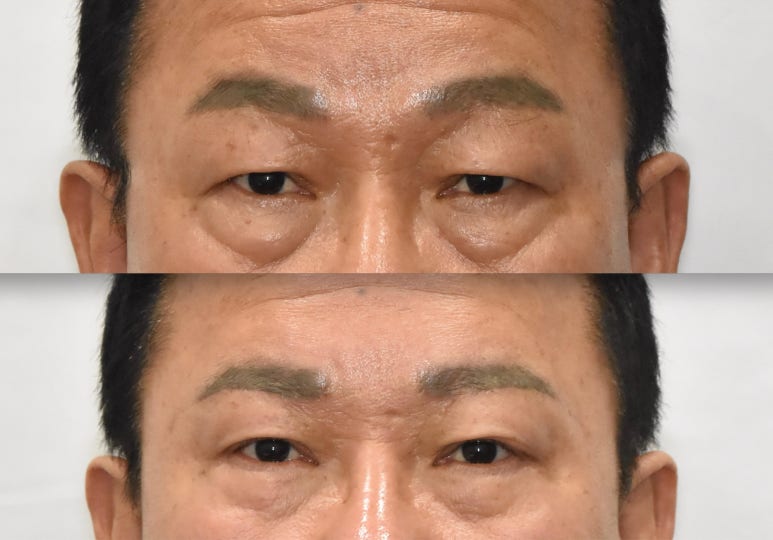 If You’re Looking Into Cosmetic Surgery as a Mother’s Day Gift for Your Parents image 5