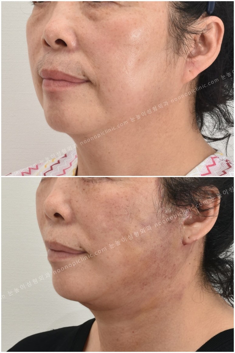 If You’re Looking Into Cosmetic Surgery as a Mother’s Day Gift for Your Parents image 12