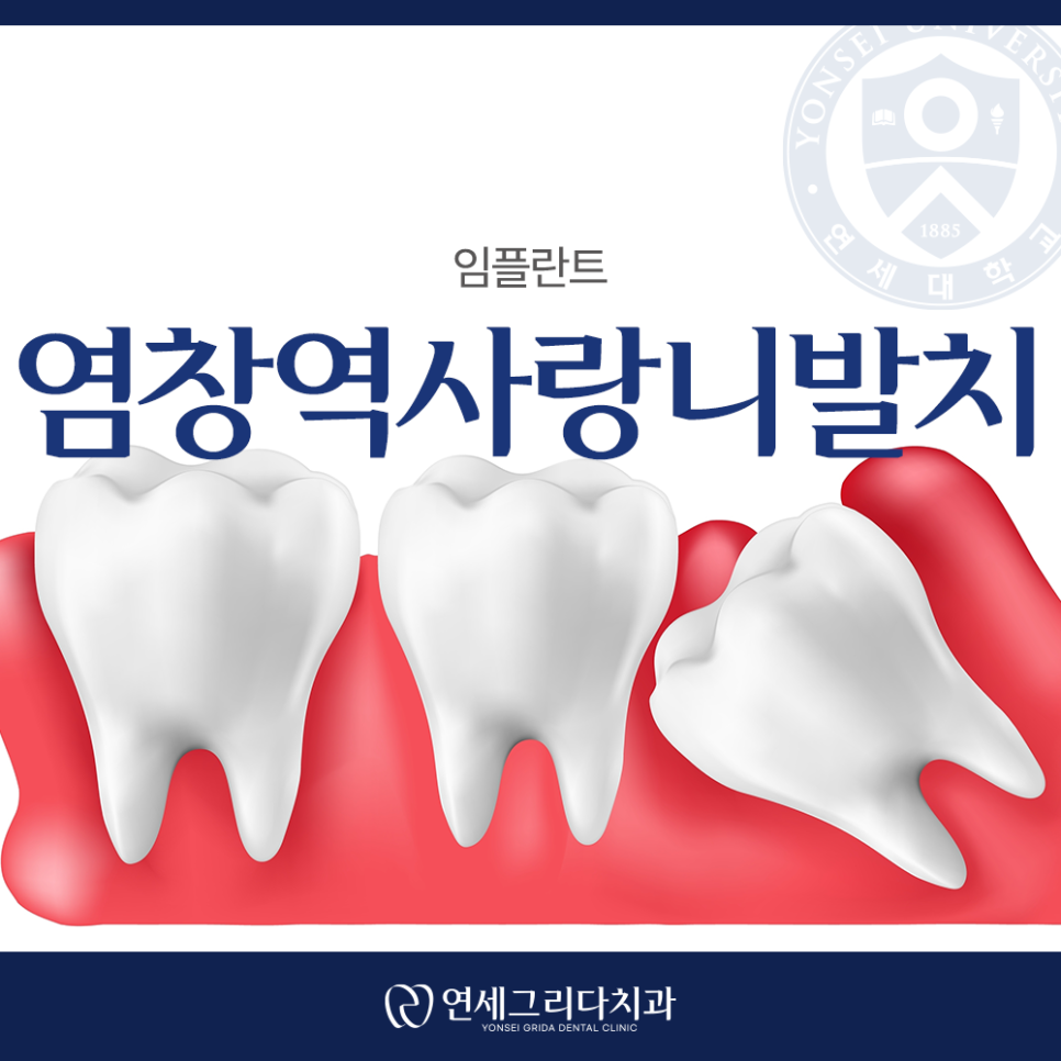 Do You Really Need to Have a Wisdom Tooth Removed at Yeomchang Station? image 1