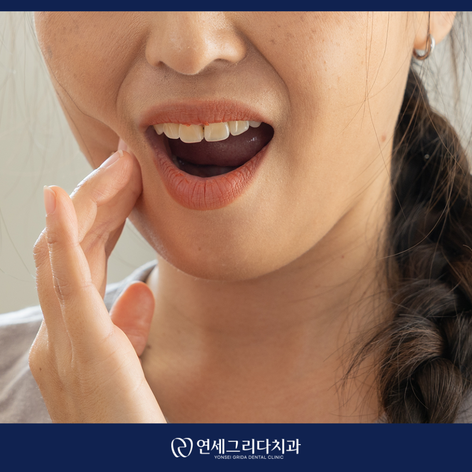 사랑니 발치 후 술을 참아야 하는 이유와 음주 가능 시기 관련 이미지 3