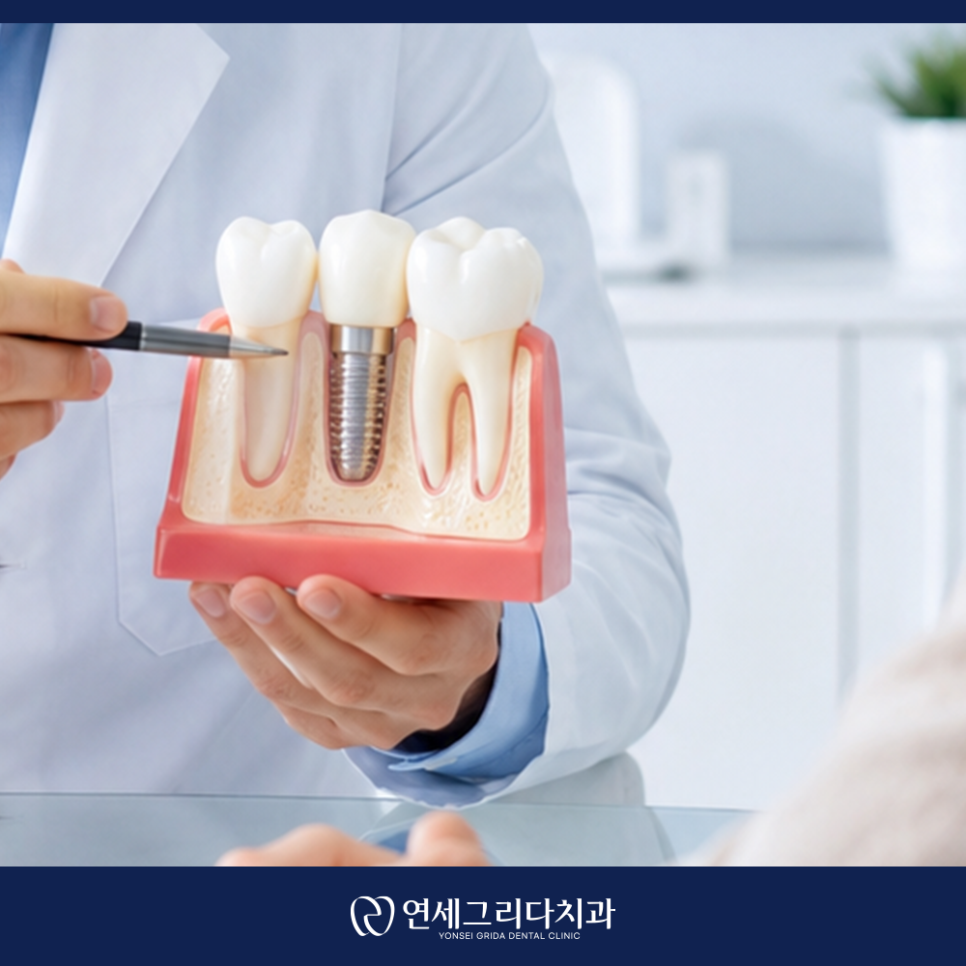 Deungchon Station Dental Implants: How to Use Them for as Long as Natural Teeth image 4