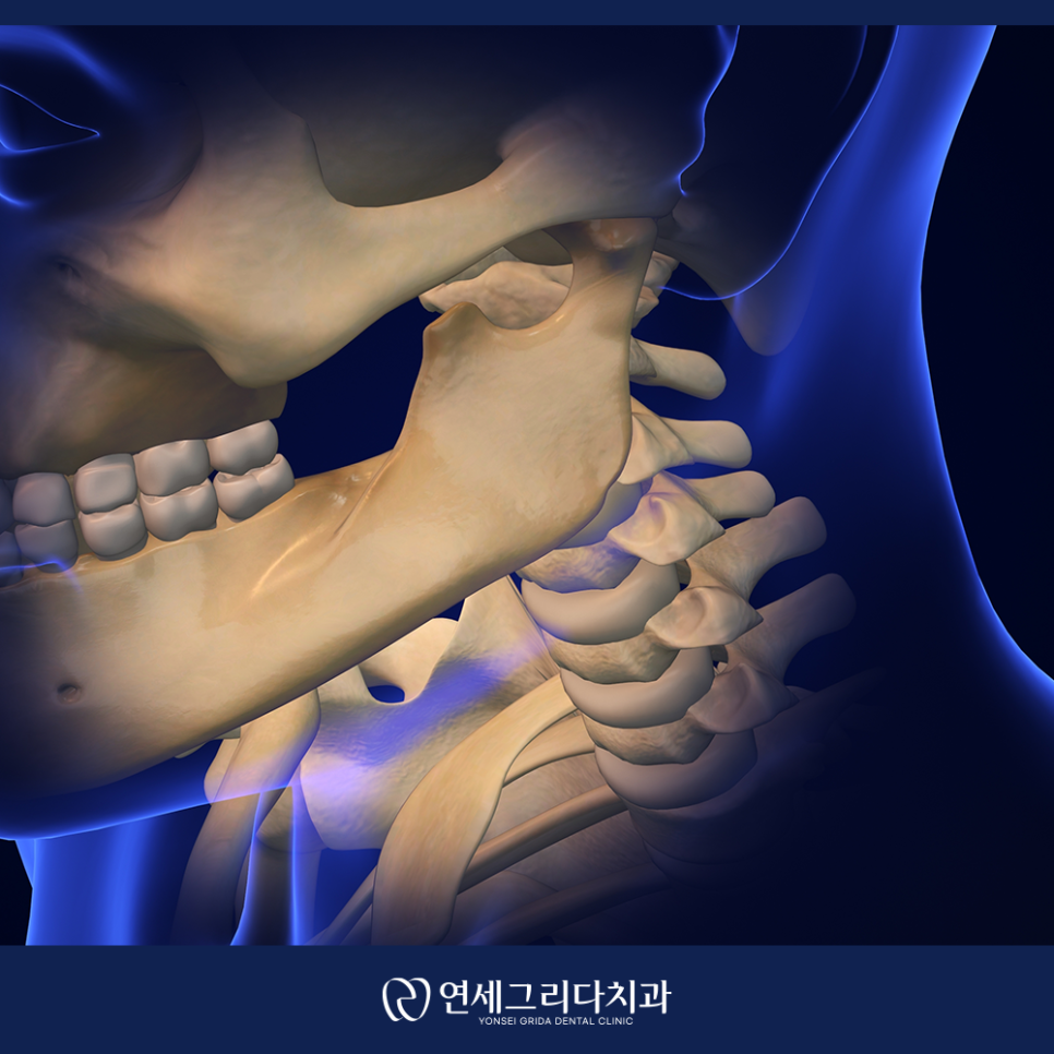 턱관절치료, 치과에서 받아야 하는 이유 관련 이미지 2