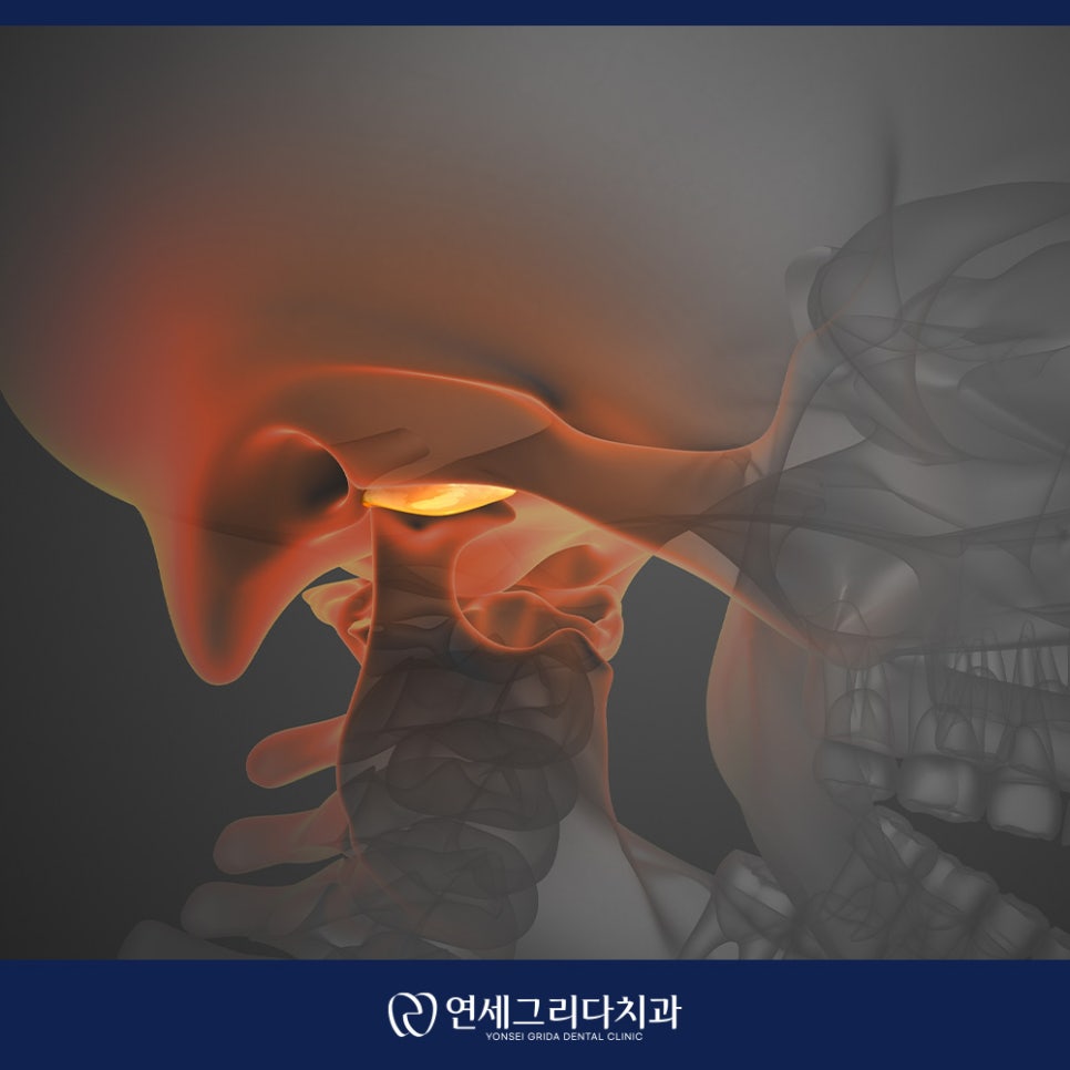 턱관절 통증 입을 벌릴 때 아픈 이유는? 관련 이미지 2