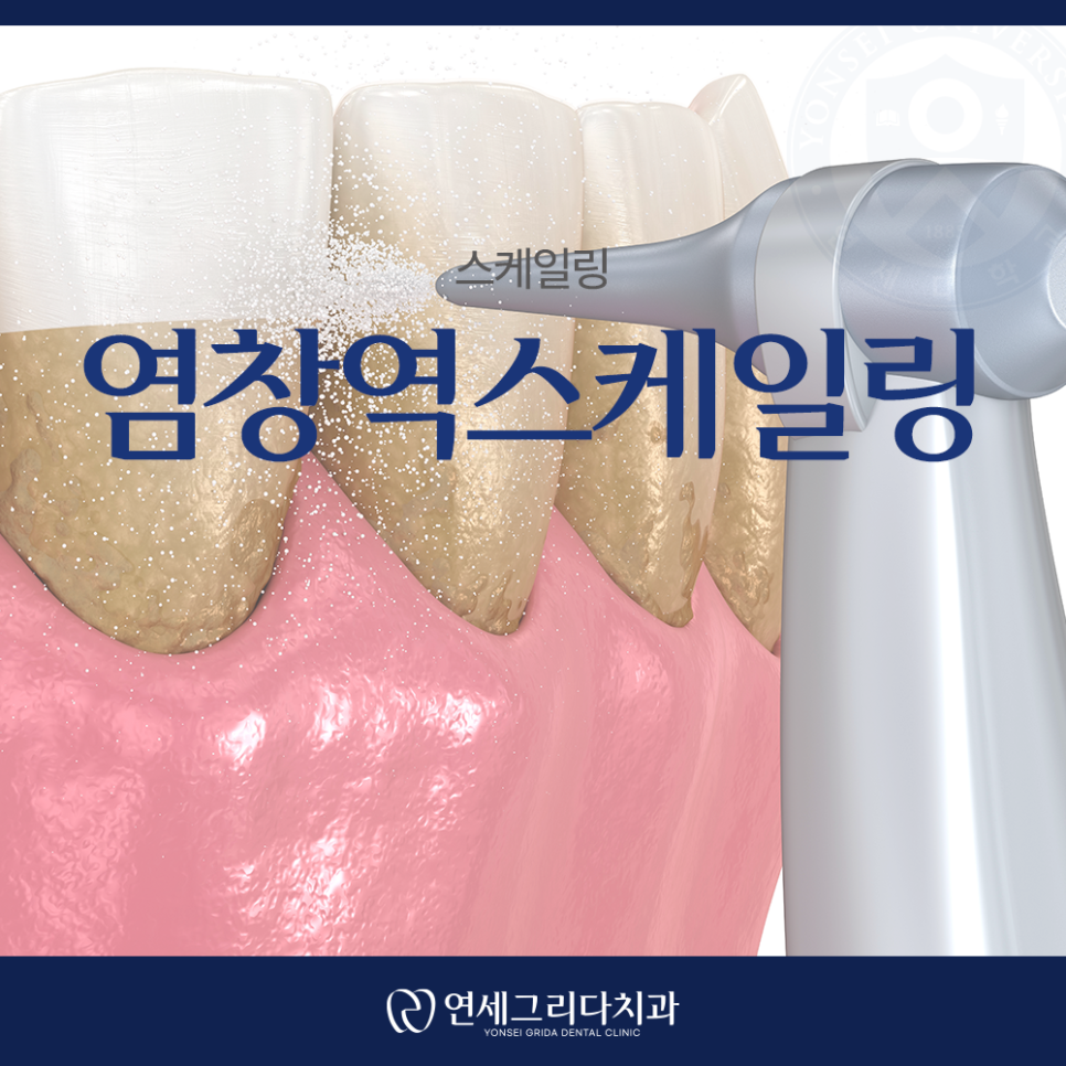 Yeomchang Station Dental Scaling: Manage It Before Tartar Builds Up image 1