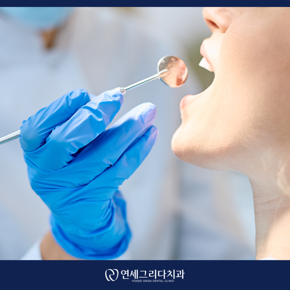 What Is That Black Spot on Your Tooth? Distinguishing Staining from Cavities image 6
