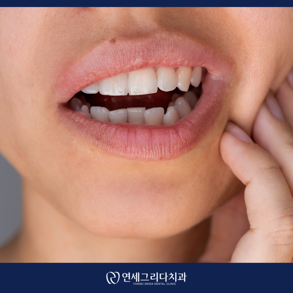 염창역치과, 임플란트 식립 후 흔들리는 느낌이 든다면? 관련 이미지 4