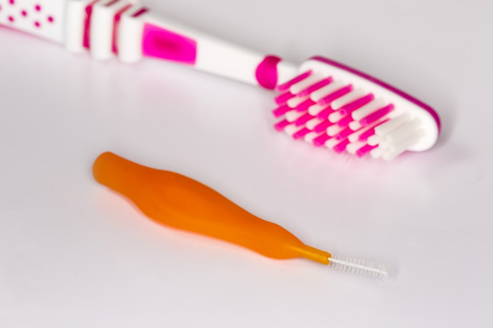 인접면 충치 조기 발견이 중요한 이유는? 관련 이미지 5