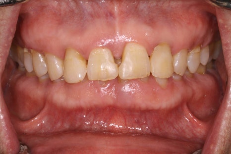 The Moment I Felt I Had Made the Right Choice in Prosthodontics image 3
