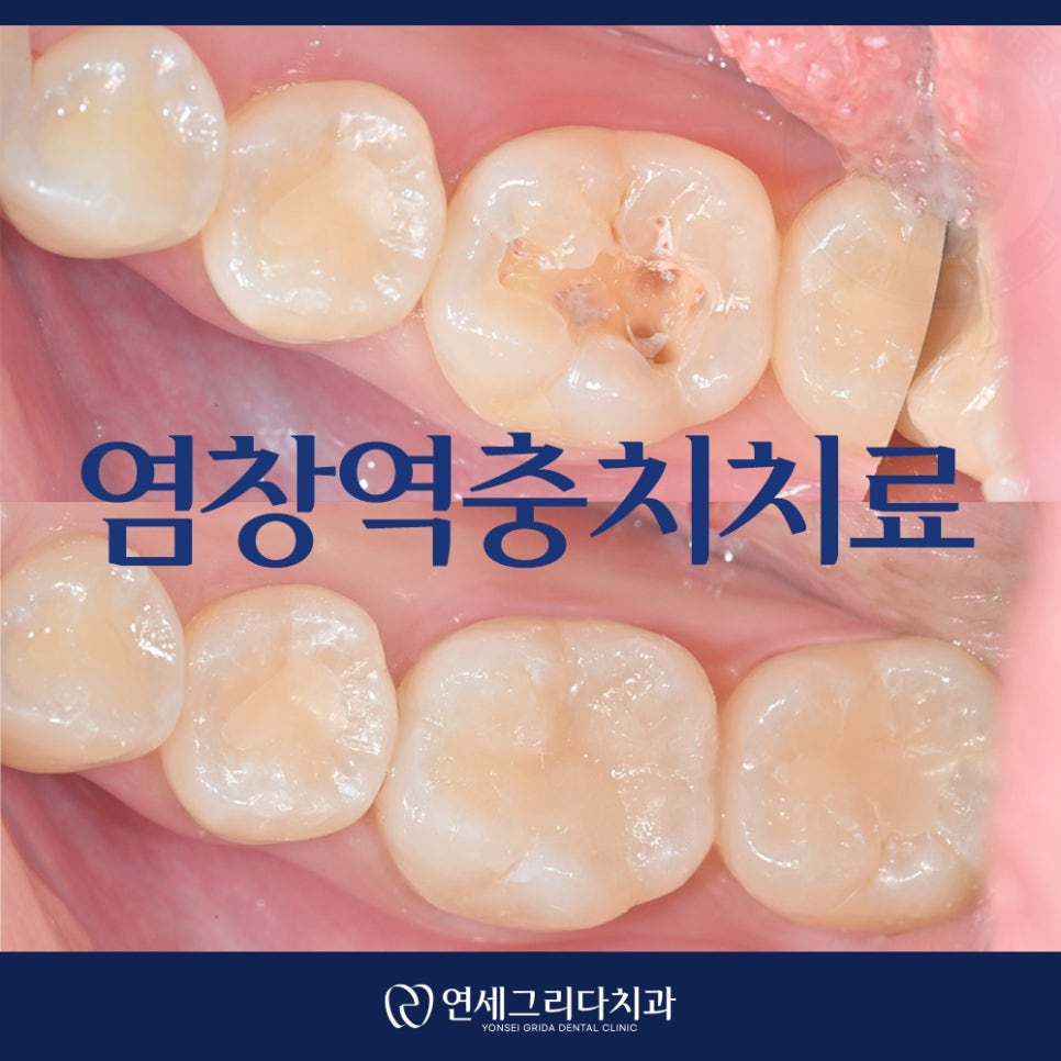 Yeomchang Station Cavity Treatment: I Visited for an Overall Checkup image 1