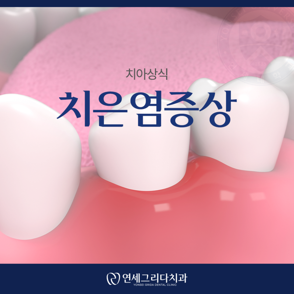 Check If Your Gums Bleed When Brushing: Symptoms of Gingivitis! image 1