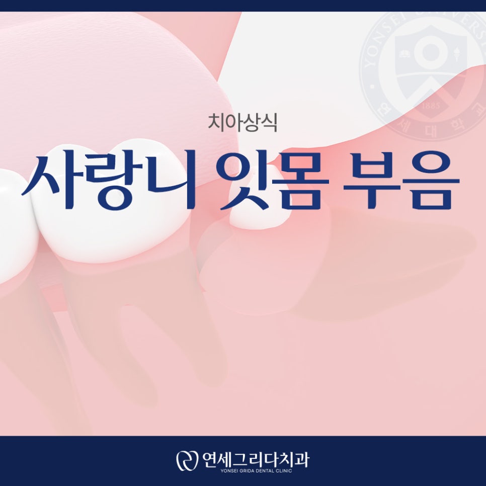 사랑니 잇몸 부음 그냥 두면 안 되는 이유는? 관련 이미지 1