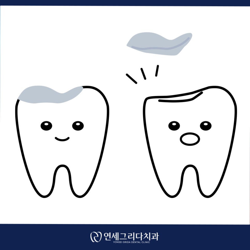 인레이 탈락 재부착이 가능할까요? 관련 이미지 3