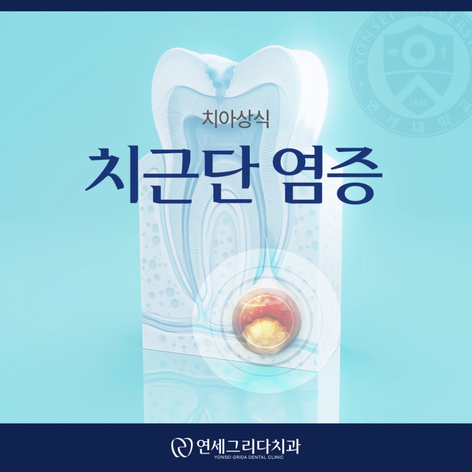 치근단 염증 잇몸에 고름이 생겼다면? 관련 이미지 1