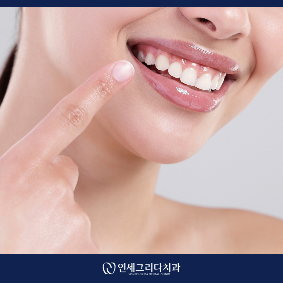 불소도포, 건강한 치아를 위한 선택 관련 이미지 6