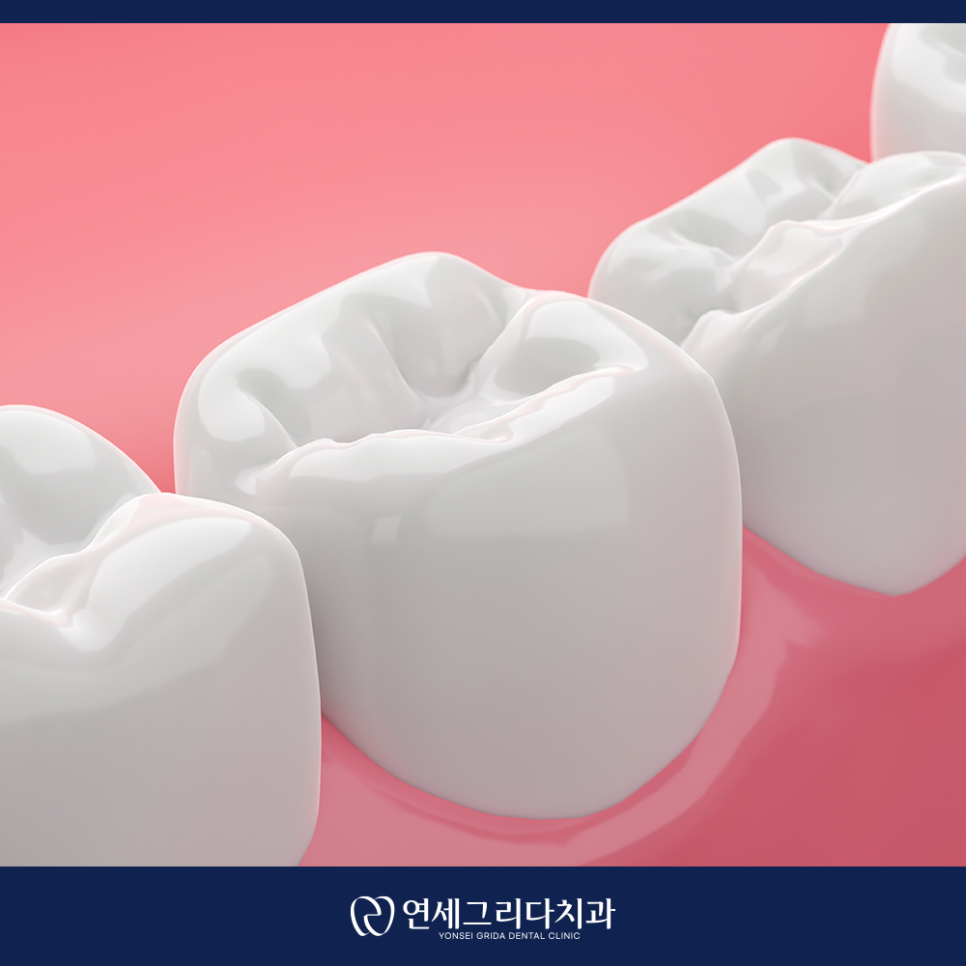 치아미백, 누런 색상이 고민이라면 관련 이미지 3